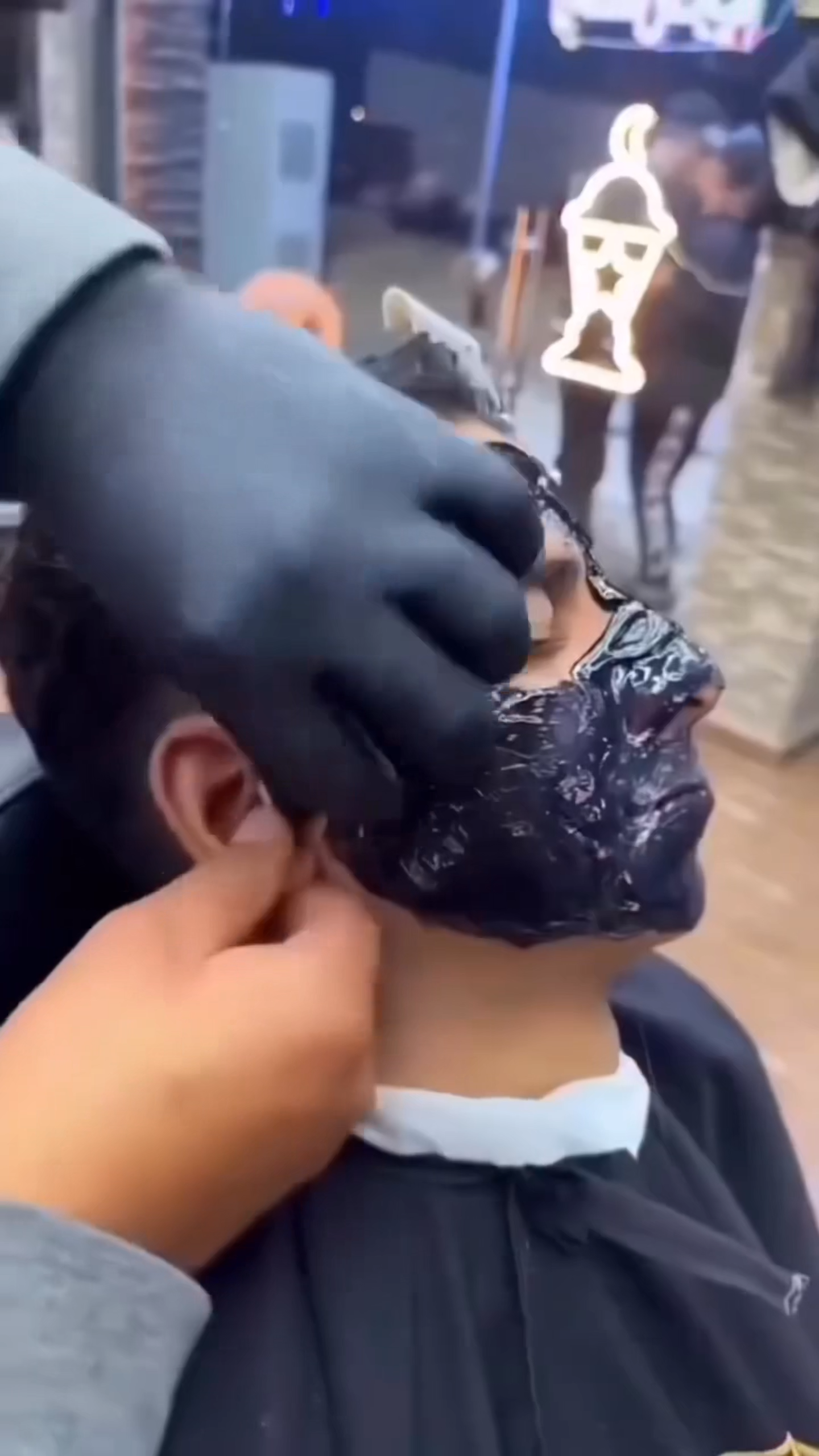 HE RIPPED MY FACE OFF